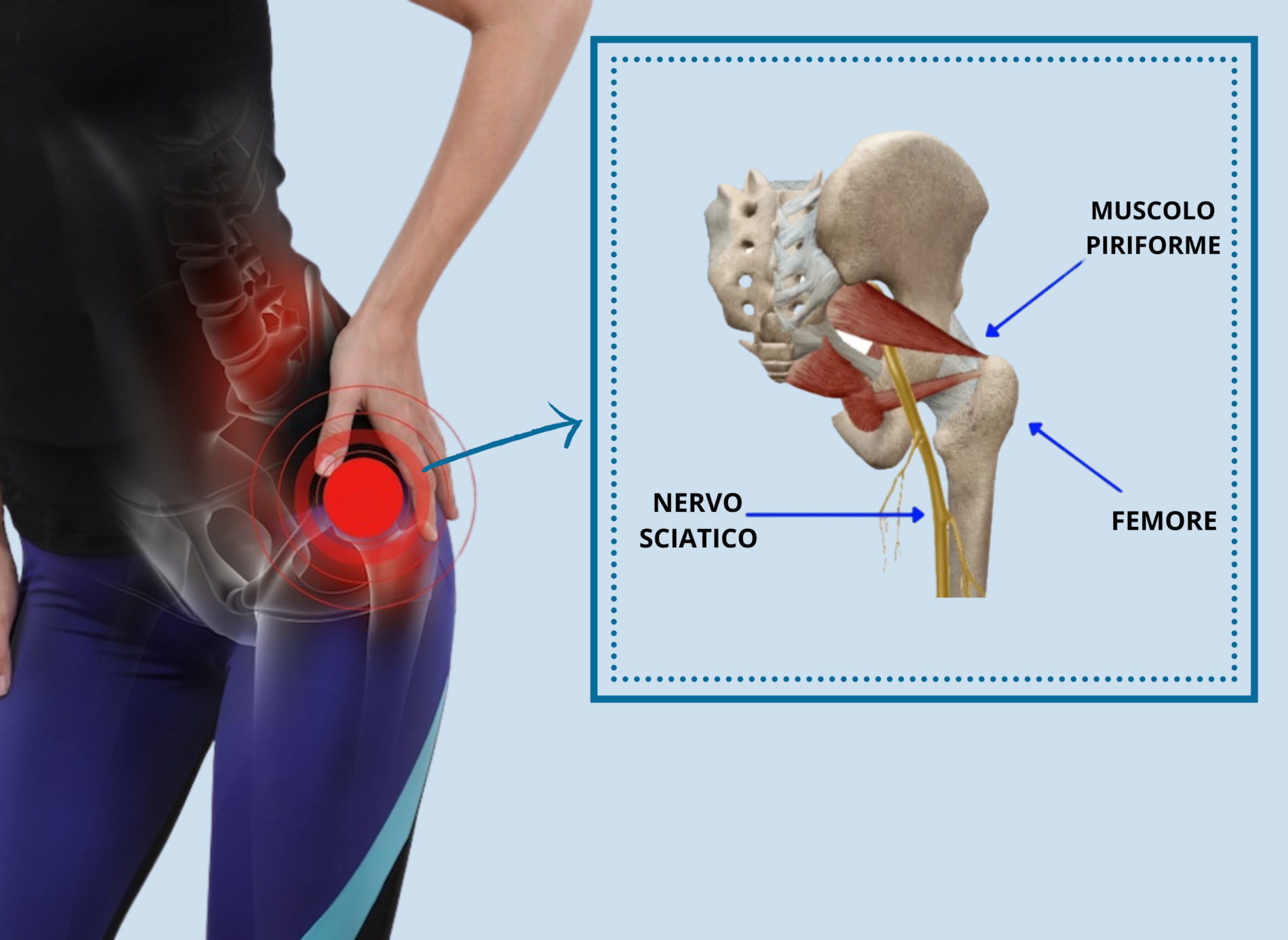 Anatomia del muscolo piriforme e del nervo sciatico